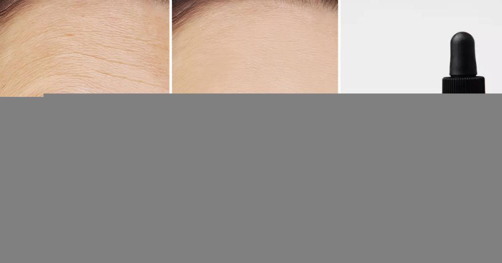 So wenden Sie Vitamin C im Gesicht an, um einen Botox-ähnlichen Effekt zu erzielen.